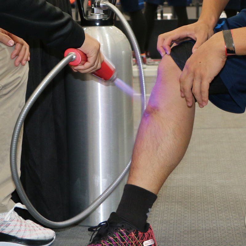 2025 Cryotherapy CO2 Device for Rapid Swelling Reduction & Pain Relief