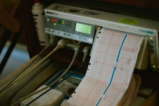 Quanto Custa um Teste de Apneia do Sono em Casa? Guia 2025