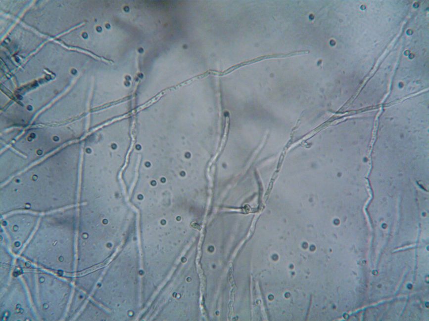 2. Key Innovation: Microbial Consortia Replace Single-Strain Products
